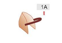 1A