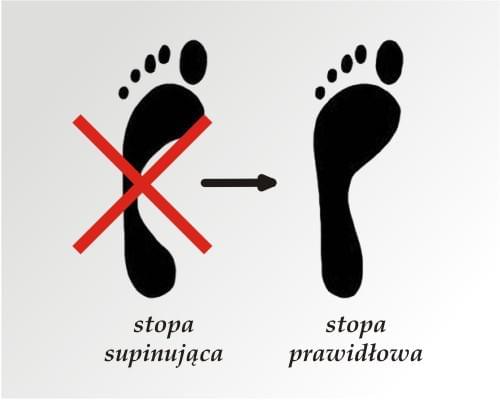 KOREKCJA SUPINACJI (95zł)